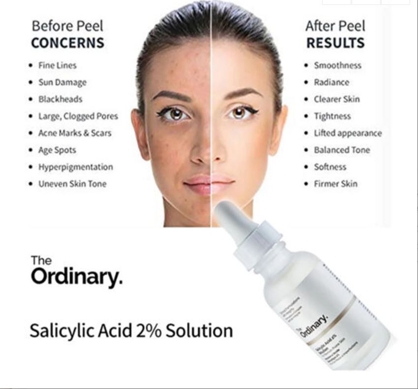The Ordinary Salicylic Acid 2% Solution